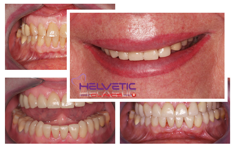 Helvetic Dental Clinics Hotel