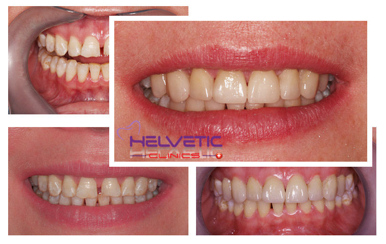 why choose Helvetic Clinics